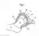 Fig. 02 - Hip joint device