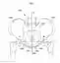 Fig. 03 - Hip joint device