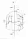 Fig. 07 - Hip joint device