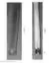 Fig. 06 - Method and apparatus for restoring articular cartilage