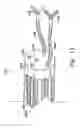 Fig. 15 - Autofocus and/or autoscaling in telesurgery