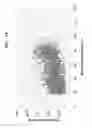Fig. 04 - METHOD OF ANALYZING PROTEIN USING DATA-INDEPENDENT ANALYSIS COMBINED WITH DATA-DEPENDENT ANALYSIS