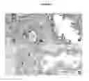 Fig. 06 - Gene expression profiles to predict relapse of prostate cancer