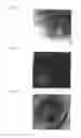 Fig. 03 - NON-HUMAN ANIMAL MODEL OF MYOCARDIAL INFARCTION AND METHOD FOR CREATING THE SAME