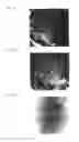 Fig. 04 - NON-HUMAN ANIMAL MODEL OF MYOCARDIAL INFARCTION AND METHOD FOR CREATING THE SAME