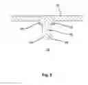 Fig. 04 - Device for adjusting the usable length of a bracelet and corresponding bracelet clasp