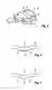 Fig. 03 - Fastening clip