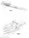 Fig. 06 - STRAP TENSIONING DEVICE