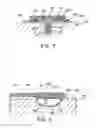 Fig. 06 - Method and apparatus for repairing concrete