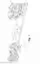 Fig. 02 - MOWER BLADE WITH REPLACEABLE INSERTS