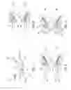 Fig. 03 - Self-oscillating fuel injection jets