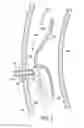 Fig. 10 - Liquid additive dispensing apparatus for a washing machine