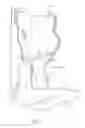 Fig. 02 - High load resistant stop lamp switch brackets and brake pedal assemblies incorporating the same