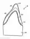 Fig. 01 - Integrated Porcelain System for a Dental Prosthesis
