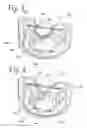 Fig. 03 - Milk tube dome with flow controller