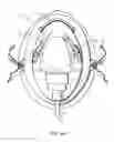 Fig. 03 - MASK FOR PROVIDING A VISUAL CUE