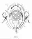 Fig. 05 - MASK FOR PROVIDING A VISUAL CUE