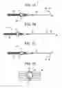 Fig. 02 - Deflectable catheter with bonded center strut and method of manufacture for same