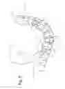 Fig. 06 - System and method for adjusting roller cone profile on hybrid bit