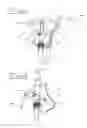 Fig. 04 - Safety device