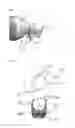 Fig. 08 - BEVERAGE CONTAINER WITH A PROTRUSION, AND SEPARABLE PROTRUSION DEVICE FOR SAME