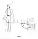 Fig. 03 - Oxygen Tube Retainer