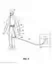 Fig. 04 - Oxygen Tube Retainer