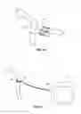 Fig. 10 - Oxygen Tube Retainer