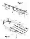 Fig. 03 - Staple formed over the wire wound closure procedure