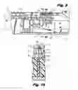 Fig. 06 - Staple formed over the wire wound closure procedure