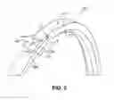 Fig. 03 - ROTATING SEAL RING WITH TARGETED SPLIT SURFACE ORIENTATION