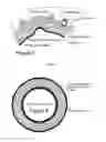 Fig. 04 - GASKET HAVING A WAVE STOPPER