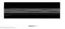 Fig. 09 - MICROCOIL MAGNETIC RESONANCE DETECTORS