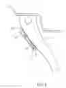 Fig. 03 - PROGRAMMABLE TIRE-CONDITION SENSOR HAVING A FLEXIBLE SHELL, ITS INSTALLATION METHOD AND A TIRE CARRYING SAME