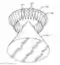 Fig. 01 - Antenna with shaped dielectric loading