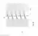 Fig. 09 - Transmissive Liquid Crystal Display with Reflective Mode