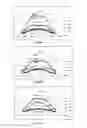 Fig. 05 - Illumination lens