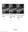 Fig. 07 - System and method for enhancing compression using skip macro block on a compressed video