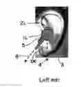 Fig. 01 - USING ACCELEROMETERS FOR LEFT RIGHT DETECTION OF HEADSET EARPIECES