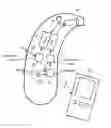 Fig. 01 - HEARING AID AND METHOD FOR OPERATING A HEARING AID WITH A HUMIDITY SENSOR