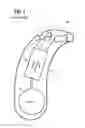 Fig. 02 - HEARING AID AND METHOD FOR OPERATING A HEARING AID WITH A HUMIDITY SENSOR
