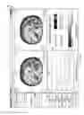 Fig. 09 - System and method for analyzing and visualizing spectral CT data