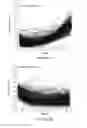 Fig. 04 - Systems and methods for generating an osteoarthritis progression predictor and systems and methods for using the predictor