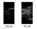 Fig. 10 - Time resolved digital subtraction angiography perfusion measurement method, apparatus and system