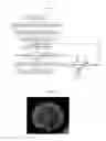 Fig. 07 - Image processing apparatus, incubation observing apparatus, and image processing method