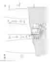Fig. 08 - Shroud leakage cover