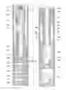 Fig. 05 - Reciprocated Pump System for Use in Oil Wells