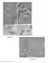 Fig. 03 - Engineered Aerosol Particles, And Associated Methods