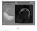 Fig. 07 - Methods for collagen imaging