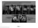 Fig. 09 - Methods for collagen imaging